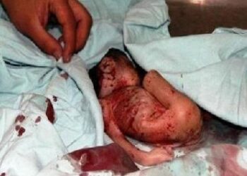 الإجهـاض – د. حسَّان بهنا أخصائي في التوليد و الجراحة النسائية – كنيسة السريان الكاثوليك