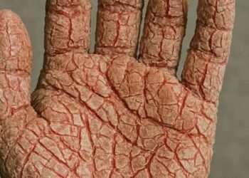 عندك مرهم للإسمنت؟ – قصة وعبرة