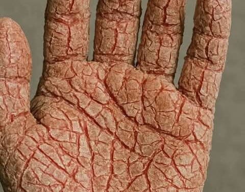 عندك مرهم للإسمنت؟ – قصة وعبرة